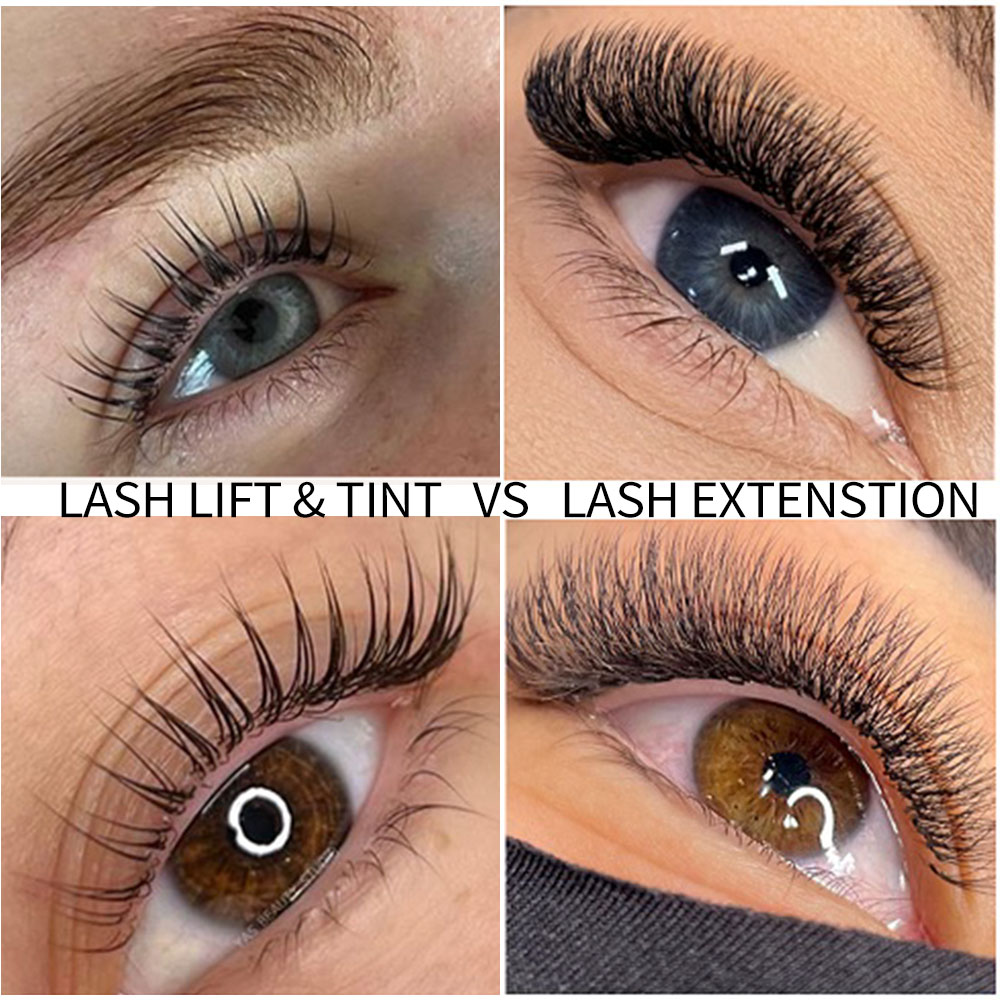 Comparison of the effects of lash lift and tint versus lash extension